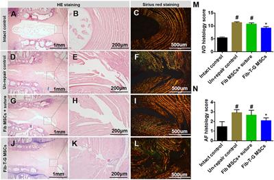 Mechanical stimulation promotes MSCs healing the lesion of intervertebral disc annulus fibrosus